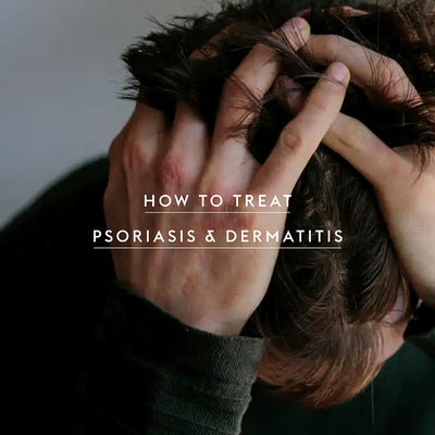 How to Treat Psoriasis & Dermatitis by Donna Aston