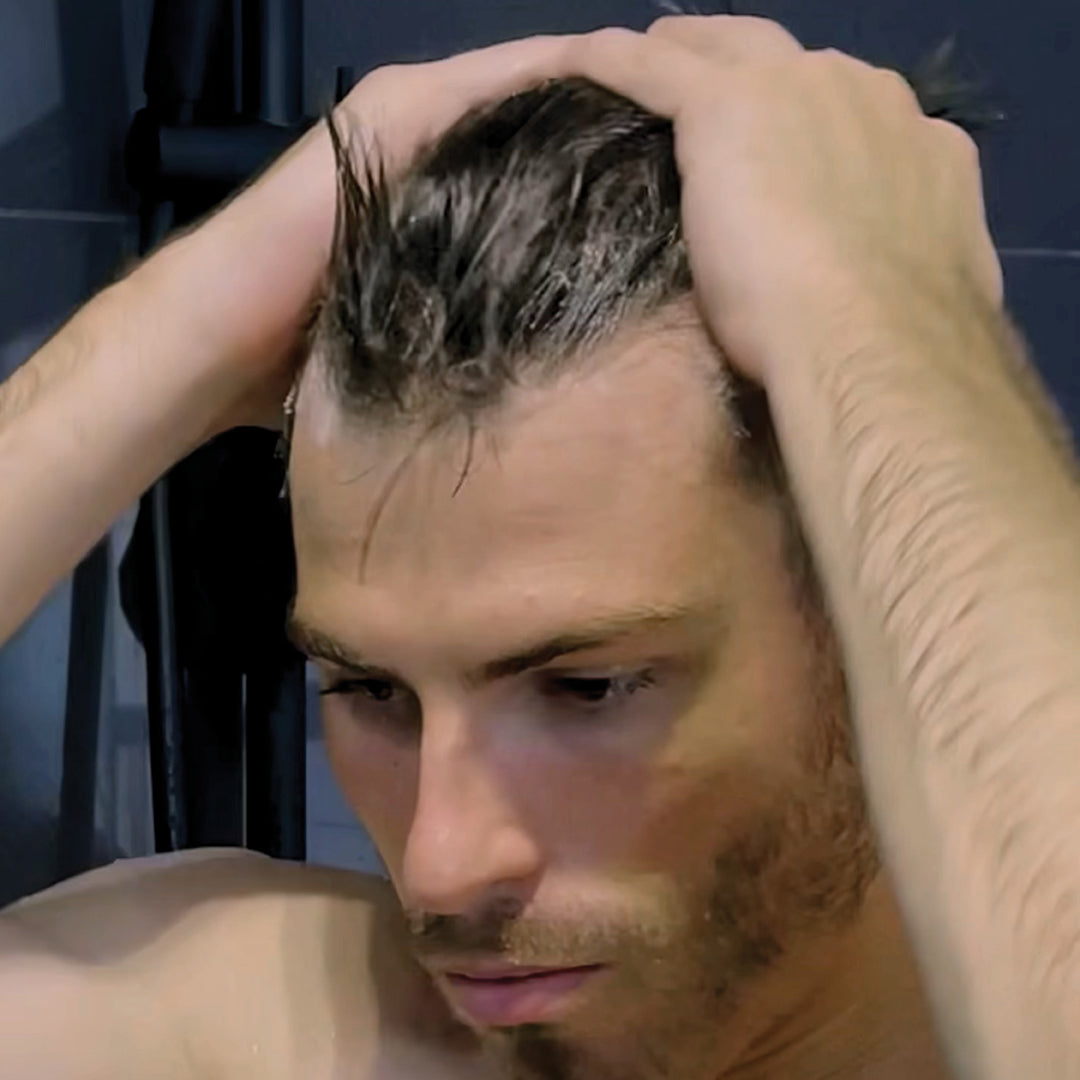 Scalp Treatment